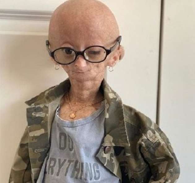 Adalia Rose