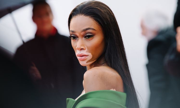 Winnie Harlow age